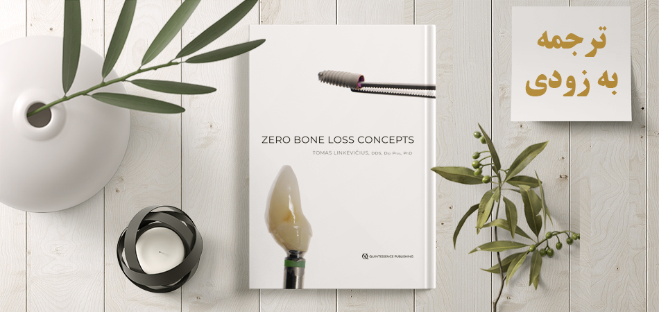 zero bone los ترجمه به زودی