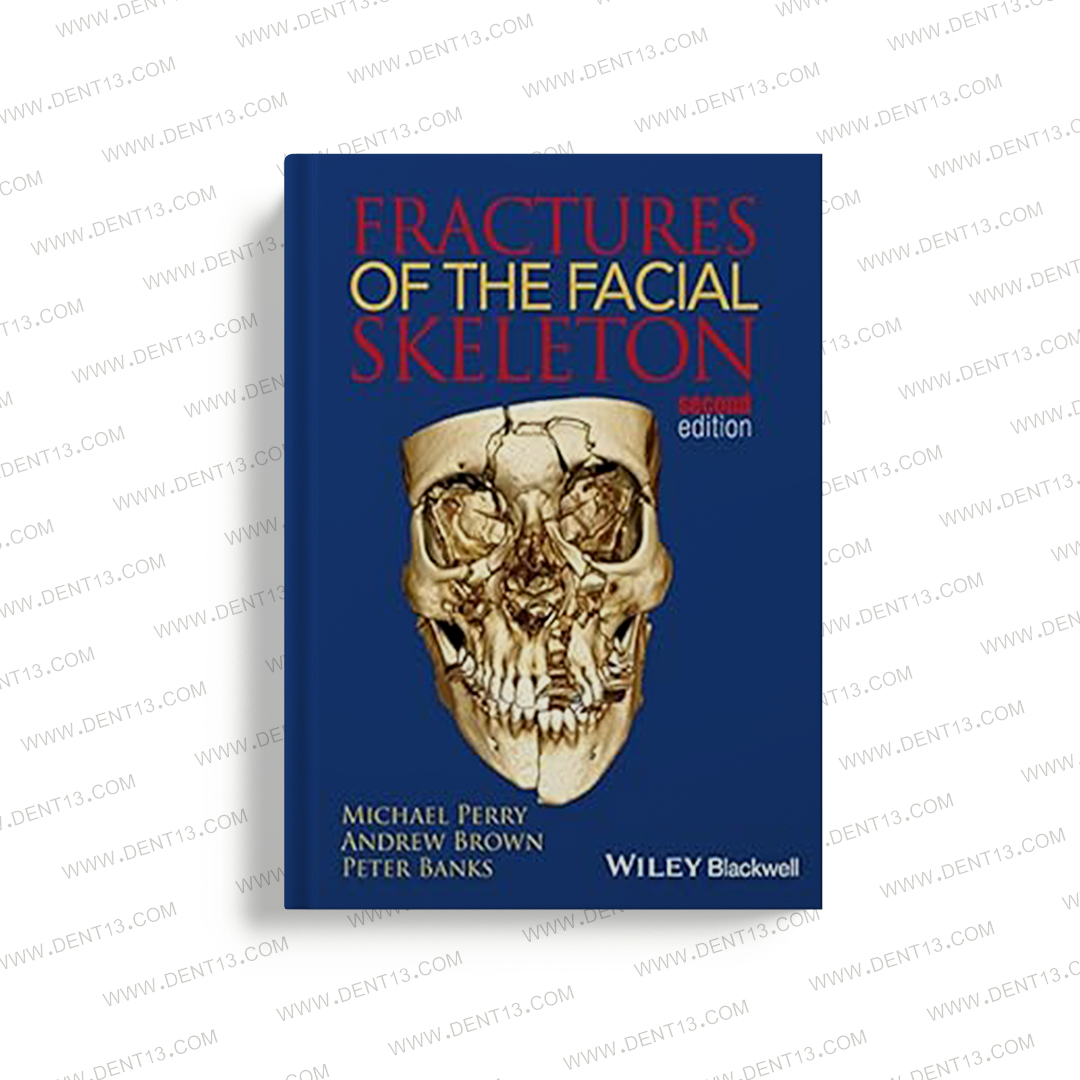 Fractures Of The Facial Skeleton Pdf