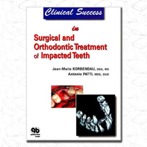 surgical & orthodontic treatment of impacted teeth