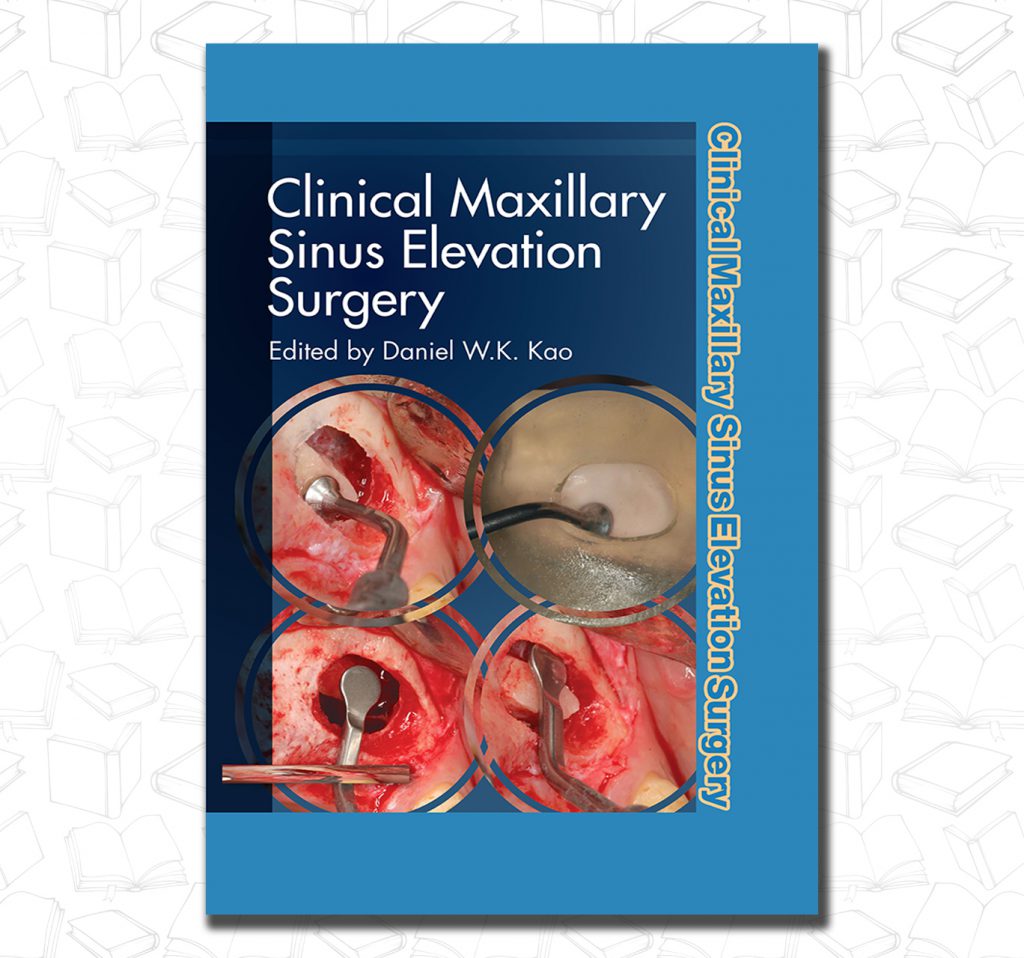 Clinical Maxillary Sinus Elevation Surgery Dent13