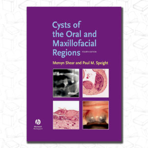Cysts of the Oral and Maxillofacial Regions