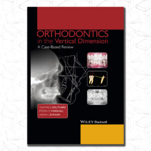 Orthodontics in Vertical Dimention