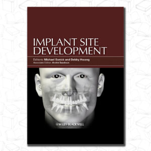 Implant Site Development