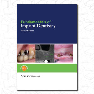 Fundamentals of Implant Dentistry