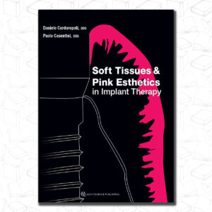 Soft Tissues and Pink Esthetics in Implant Therapy
