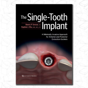 The Single-Tooth Implant : A Minimally Invasive Approach for Anterior and Posterior Extraction Sockets