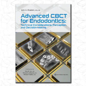 Advanced CBCT for Endodontics: Technical Considerations, Perception, and Decision-Making