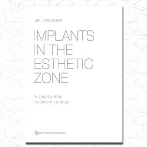 Implants in the Esthetic Zone: A Step-by-Step Treatment Strategy
