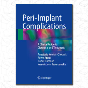 Peri-Implant Complications: A Clinical Guide to Diagnosis and Treatment