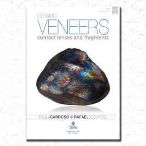 Ceramic veneers: contact lenses and fragments