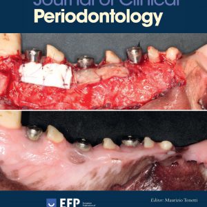 Journal of Clinical Periodontology 2020