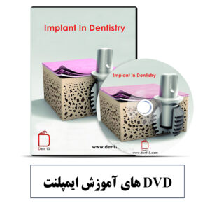 DVD Implantdentistry