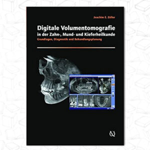 Cone-beam Volumetric Imaging in Dental, Oral and Maxillofacial Medicine: Fundamentals, Diagnostics and Treatment Planning