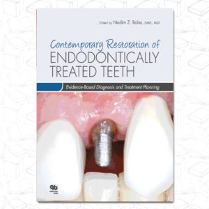 Contemporary Restoration of Endodontically Treated Teeth