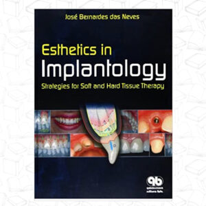 Esthetics in Implantology: Strategies for Soft and Hard Tissue Therapy