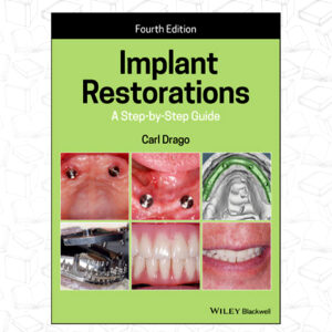 Implant Restorations: A Step-by-Step Guide 4th Edición