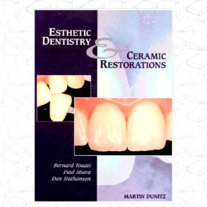 Esthetic Dentistry and Ceramic Restoration