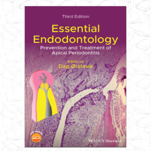 Essential Endodontology: Prevention and Treatment of Apical Periodontitis, 3rd Edition