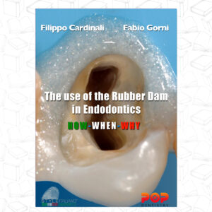 the use of the rubber dam in endodontics-H OW - WH E N - WH Y