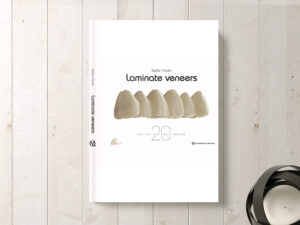 Laminate Veneers: 20 Recipes for Smile Design