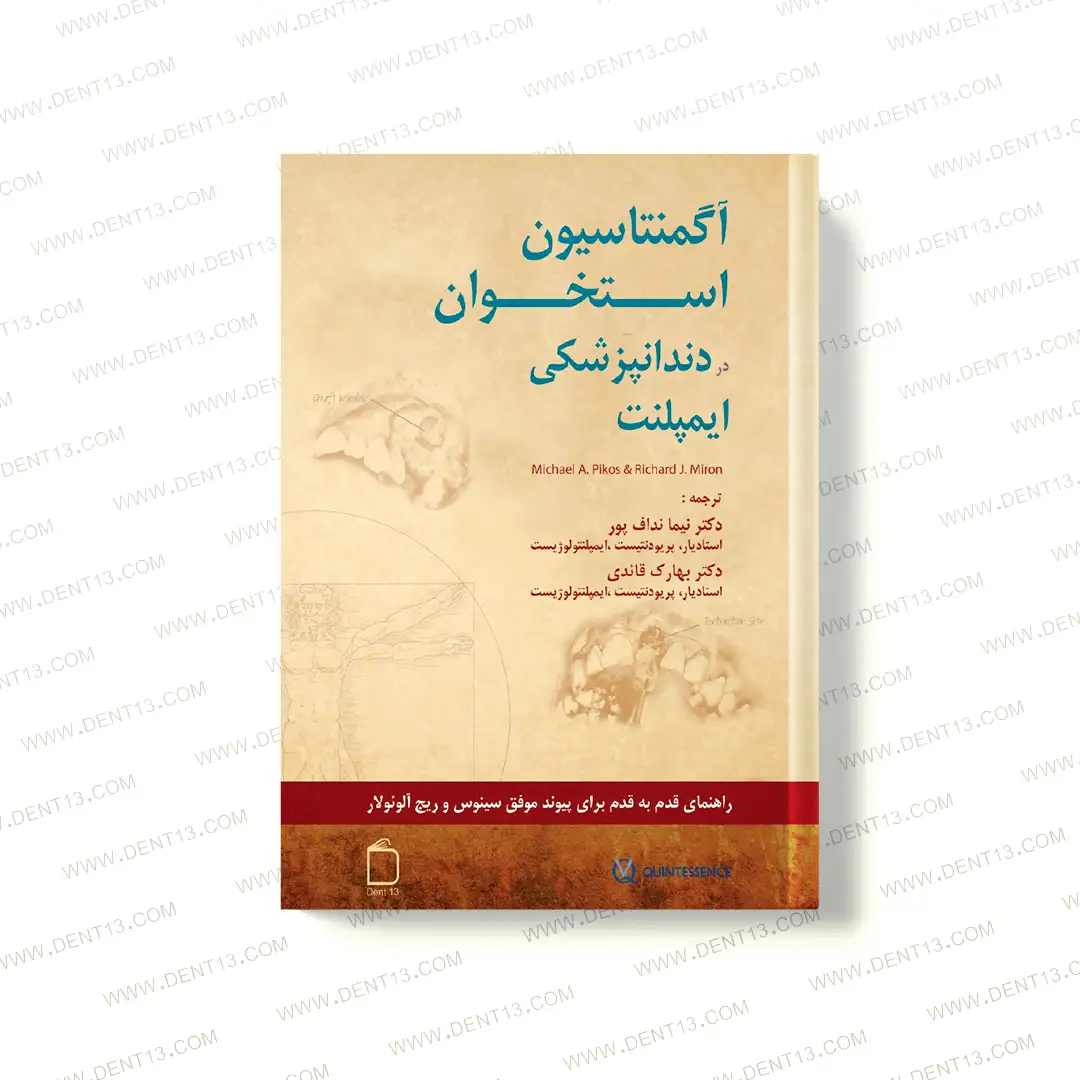 آگمنتاسیون